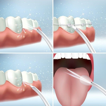 IRRIGADOR DENTAL PRO: LIMPIEZA PROFUNDA, Y LIMPIEZA IMPECABLE