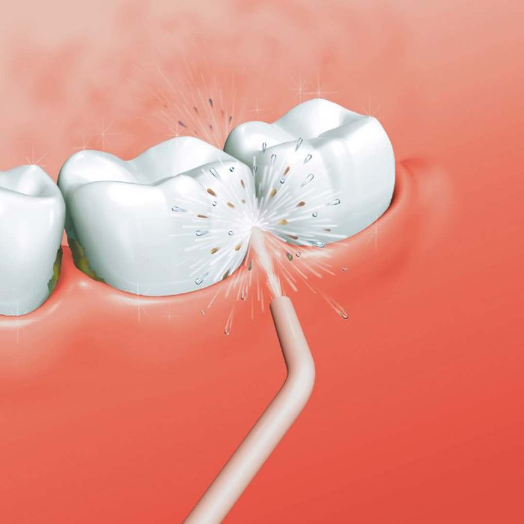 IRRIGADOR DENTAL PRO: LIMPIEZA PROFUNDA, Y LIMPIEZA IMPECABLE